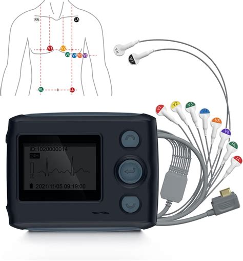 ecg test machine|24 hour ecg monitor uk.